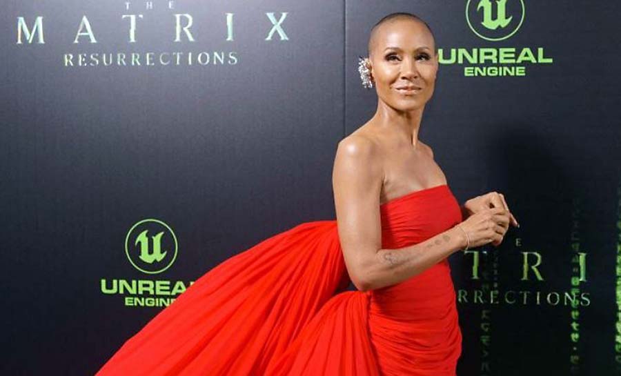 Entenda a doença de Jada Pinkett Smith que provoca queda de cabelo