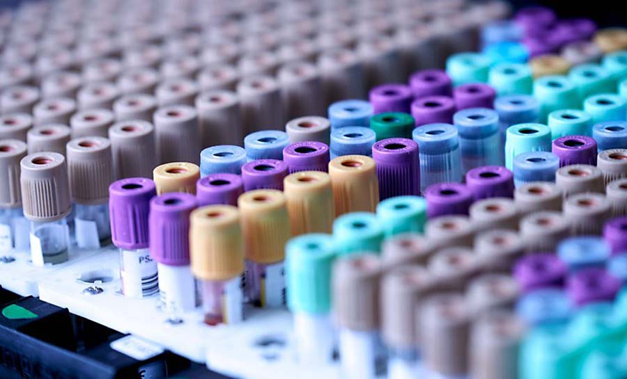 Onda de casos de hepatite em crianças alerta comunidade científica