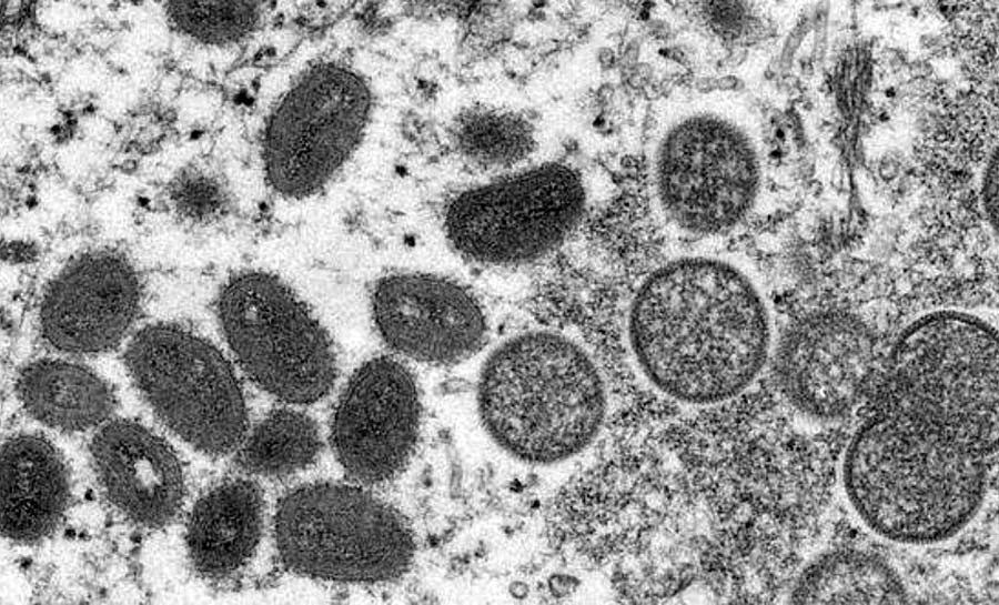 Varíola dos macacos: homens com menos de 40 anos são os mais afetados