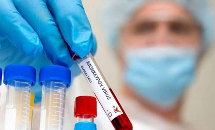 Saúde notifica caso suspeito de monkeypox