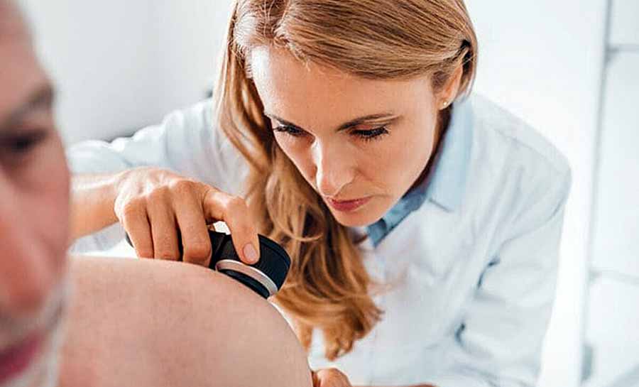 Autoexame é importante para identificar mudanças em pintas e melanomas