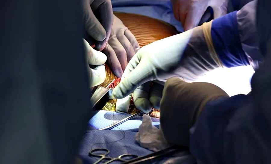 Médico brasileiro comanda transplante inédito de rim de porco nos EUA