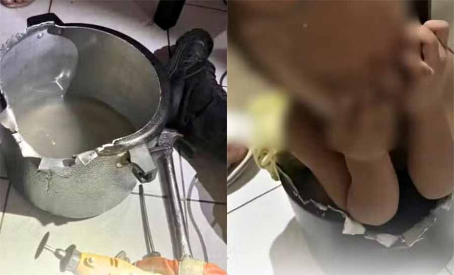 Menino de 1 ano fica entalado em panela de pressão no Ceará