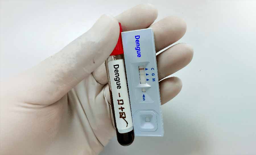 Acre anuncia distribuição de 47,5 mil testes rápidos para diagnóstico de dengue pelo Ministério da Saúde