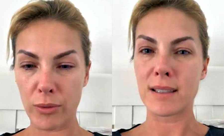 Ana Hickmann desabafa: ‘Meu agressor continua me agredindo’