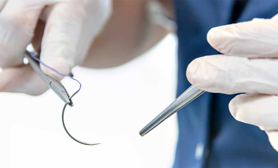 Lei que autorizava enfermeiros a fazerem suturas simples é derrubada no Acre