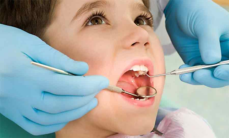 Cárie infantil: como prevenir desde os primeiros dentinhos