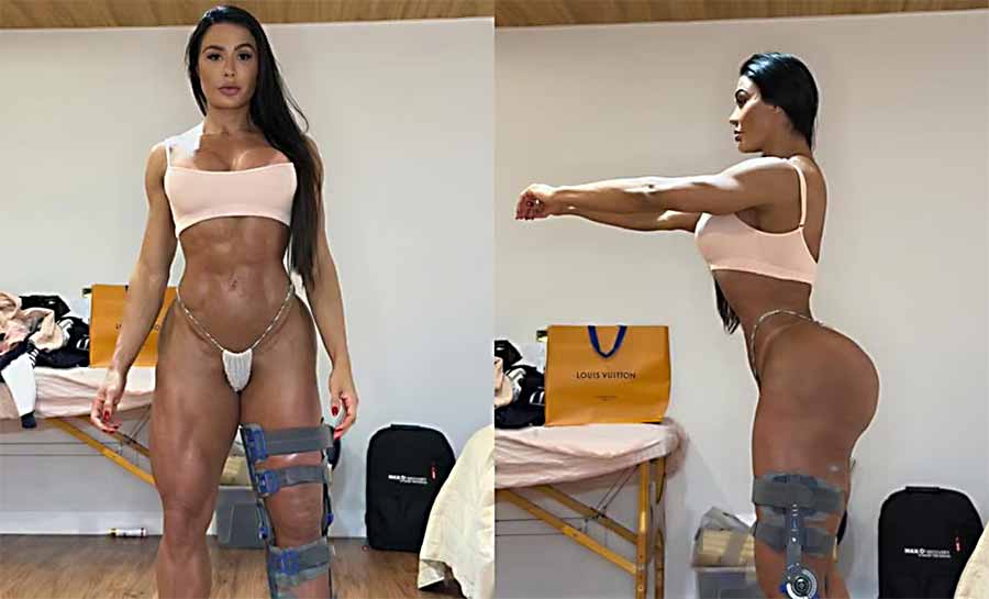 Gracyanne Barbosa exibe o corpo após lesão no “Dança dos Famosos”